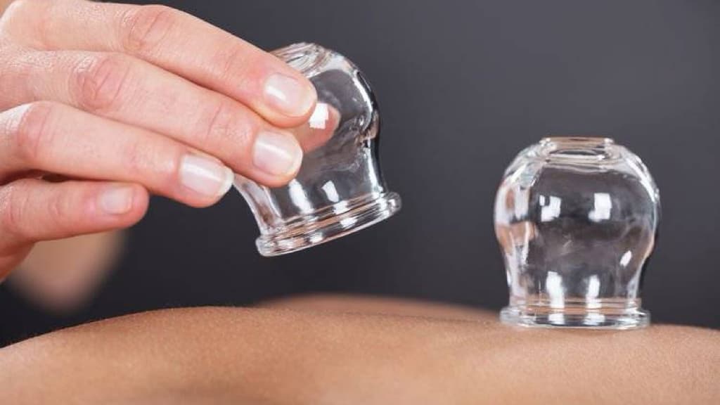 TCM Cupping — Treats Respiratory Conditions