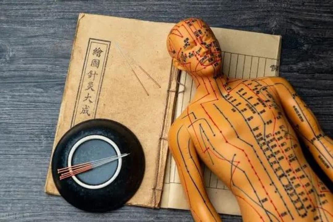 Acupuncture